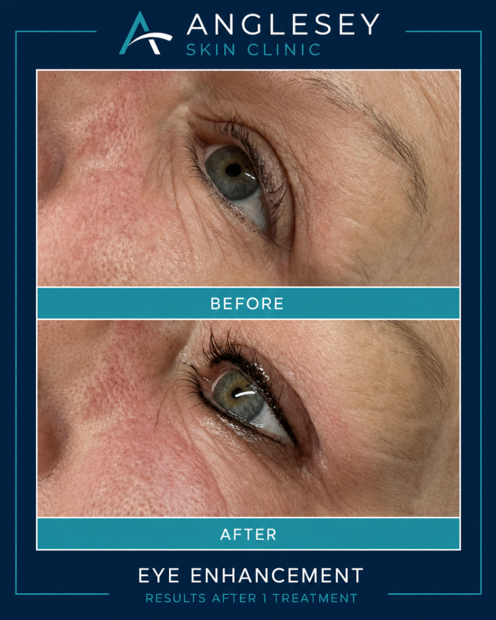 Eye enhancement result showing before and after improvement around the eye area